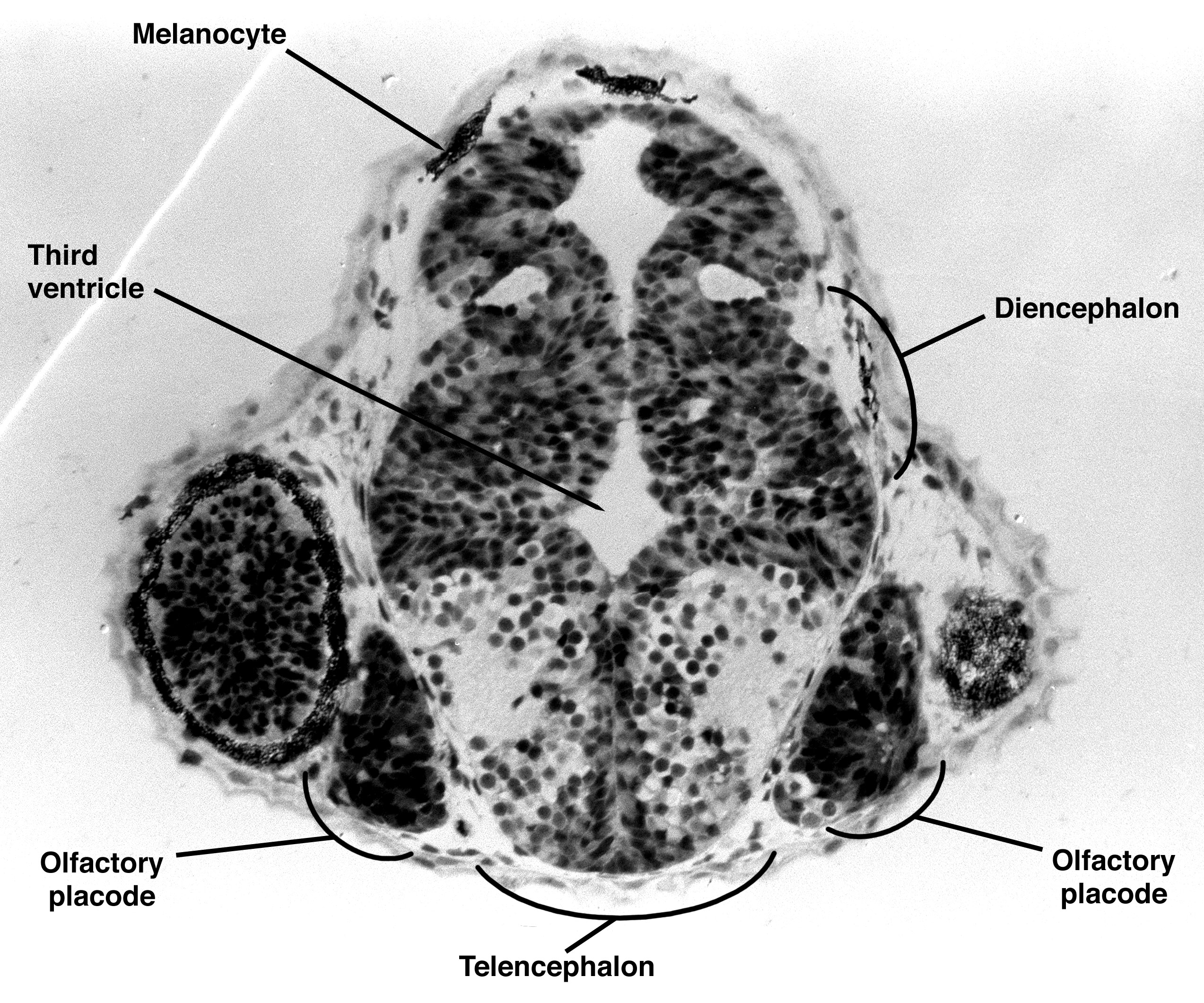 ZFIN 48 hrs lateral, picture 2